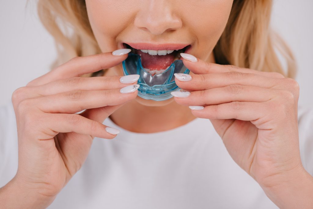 woman fitting an oral therapy appliance for sleep apnea